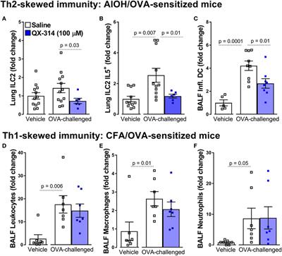 Sense and Immunity: Context-Dependent Neuro-Immune Interplay